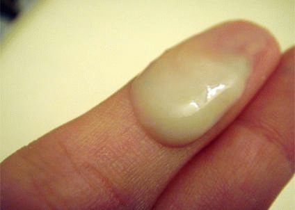 Белые выделения во время овуляции