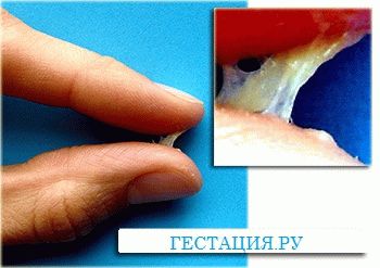 Клейкие выделения 