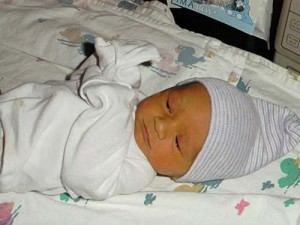Желтушка у новорожденных фото