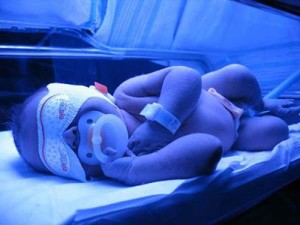 Лечение желтухи у новорожденных картинка