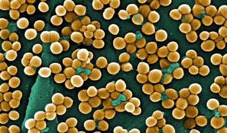 Bakterii razvivayushchie zolotistyy stafilokokk