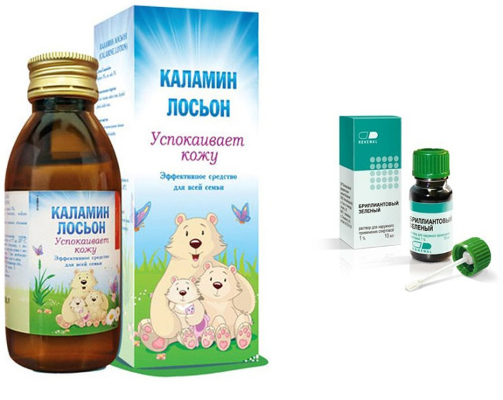 Чем снять зуд при ветрянке у ребенка: Супрастин, Зодак, Фенистил гель и другие средства