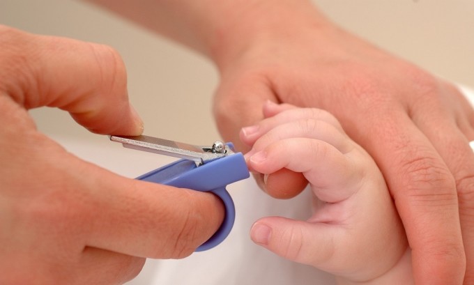 При несоблюдение правил гигиены младенца, подстригания ногтей может образоваться вросший ноготь