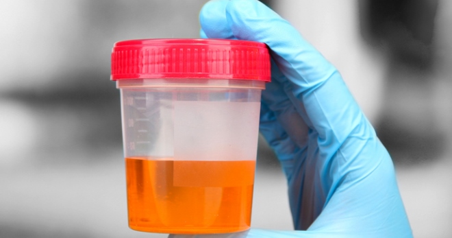 Кетоны в моче у ребенка — причины повышенных показателей, норма у детей, необходимое лечение