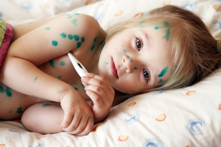 Можно ли повторно заболеть ветрянкой — какова вероятность, что ребенок заразиться снова?