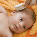 Корочки на голове у новорождённых — что это. Как убрать корочки на голове у новорождённых, нужно ли их счищать?