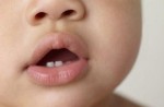 Первые зубы у младенцев: симптомы и признаки прорезывания