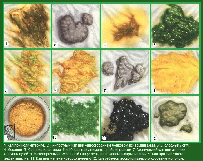 Понос у грудничка при грудном вскармливании, у новорожденного: что делать?