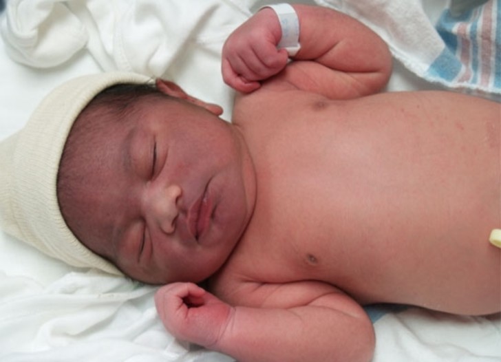 Синеет носогубный треугольник у грудничка: причины цианоза у ребенка (Комаровский)