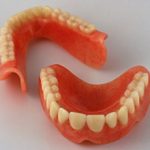 Зубной протез на присосках: плюсы, минусы и особенности