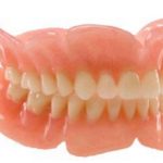 Акриловые протезы для зубов: плюсы и минусы