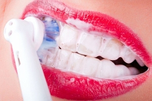 Другие способы отбеливания зубов