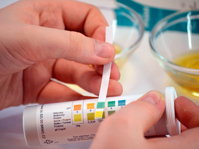 Ацетон в моче у ребенка: симптомы и лечение при повышенных показателях в домашних условиях