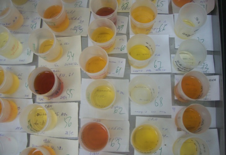 Бесцветная моча у ребенка, желтая или оранжевая: возможные причины и варианты нормы