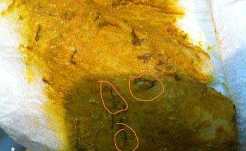 Черный кал у ребенка: ниточки, крупинки, точки и прожилки в стуле (фото)