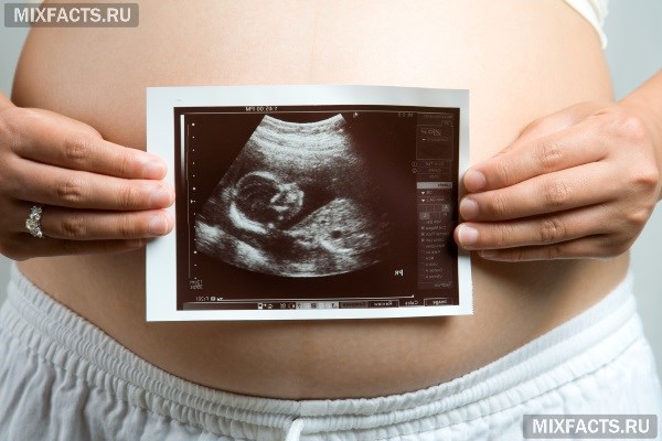 Что такое скрининг при беременности в 12 недель: как его делают, каковы нормы УЗИ?