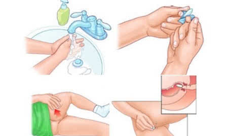 Геморрой после родов: лечение при грудном вскармливании — свечи, мазь