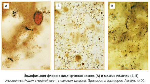 Йодофильная флора в кале у ребенка, патологические бактерии в копрограмме: что это значит?
