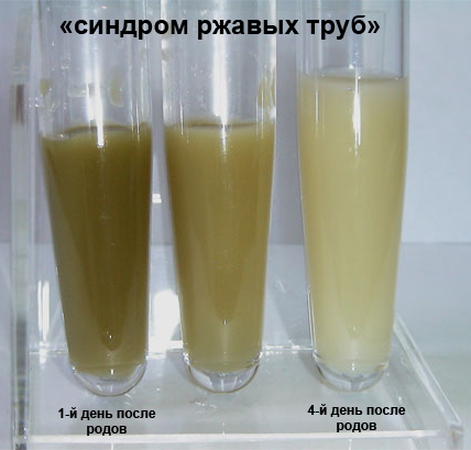Какого цвета грудное молоко: почему оно желтое, прозрачное, зеленоватое
