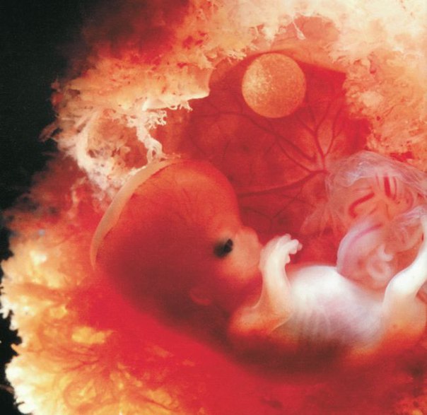 Когда у эмбриона начинает биться сердце: на какой неделе слышно сердцебиение у плода?