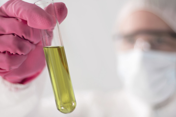 Лейкоциты в моче при беременности: норма в 1, 2 и 3 триместрах, причины повышенных показателей