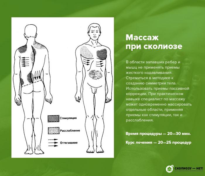 Массаж при сколиозе у детей — правила растирания спины при искривлении позвоночника (видео)