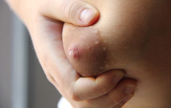 Молозиво при беременности: когда появляются выделения из груди и как выглядят?