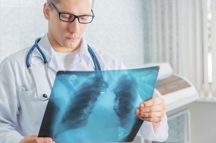 Можно ли делать флюорографию кормящей маме, рентген при грудном вскармливании?