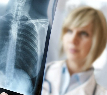 Можно ли делать флюорографию при беременности на ранних сроках, как она влияет на ребенка?