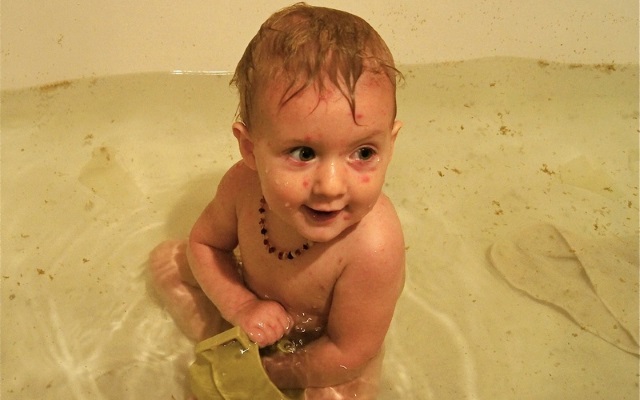 Можно ли купать ребенка при ветрянке, когда мыть после заболевания?