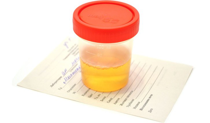 Оксалаты в моче у ребенка: что это значит, какова норма и особенности диеты при оксалатурии?