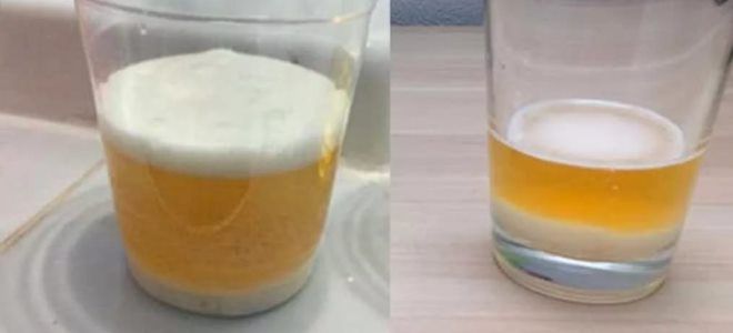 Определение беременности с помощью соды в домашних условиях: как правильно провести тест?