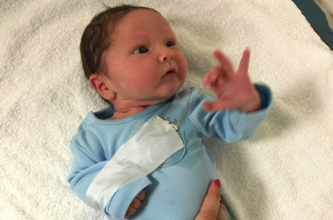 Перелом ключицы у новорожденного при родах: последствия для ребенка