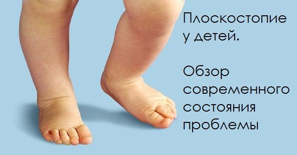 Плоскостопие у детей: причины, профилактика и методы лечения в домашних условиях