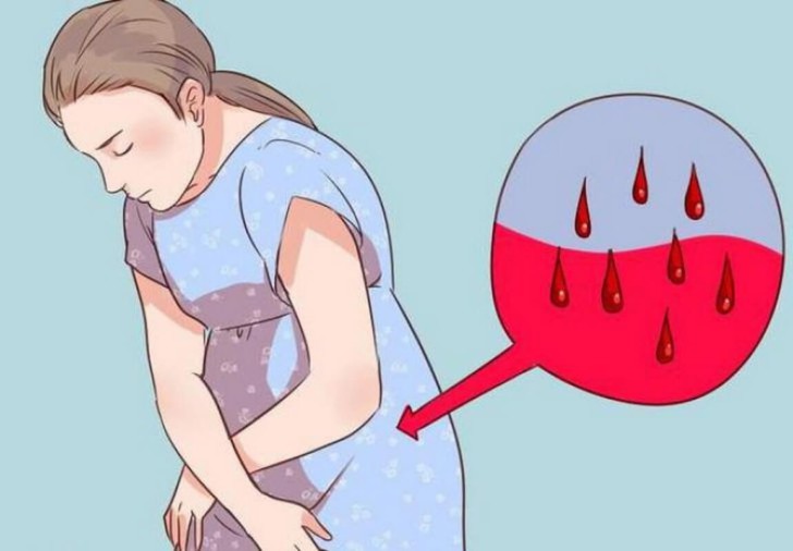 Почему месячные идут долго: какие причины длительной менструации и что делать?