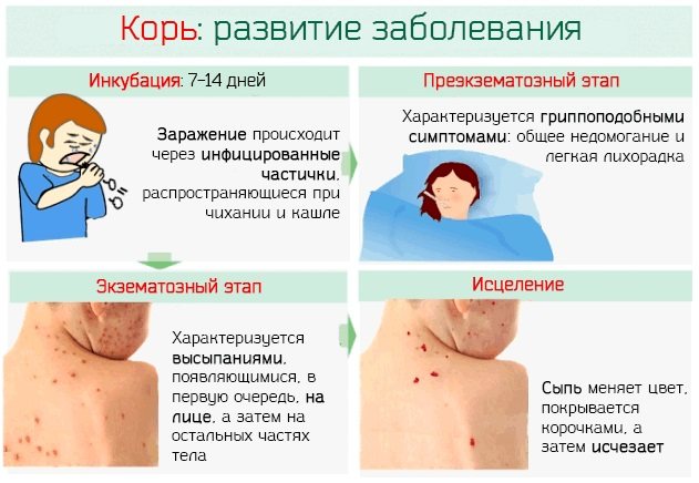 Прививка корь, краснуха, паротит (КПК): побочные действия, реакции и названия вакцин