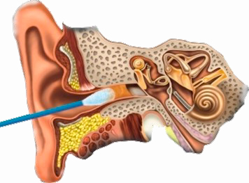 Пробки в ушах у ребенка: что делать в домашних условиях?
