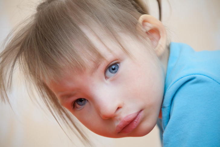 Синдром Лежена: симптомы с фото, причины, диагностика и тактика терапии