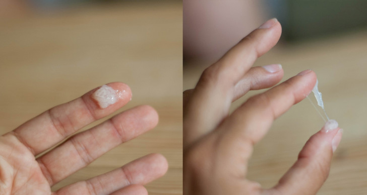 Слизистые выделения при беременности на ранних сроках, во втором и третьем триместрах