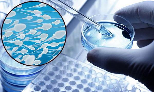 Спермограмма по Крюгеру: как сделать анализ, каковы критерии оценки результата и нормы, калькулятор