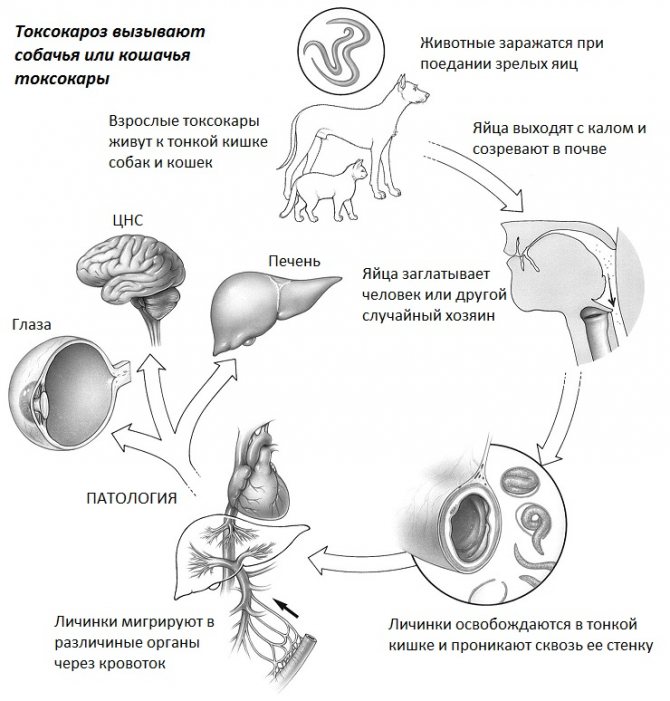 Токсокароз у детей: симптомы и лечение, причины появления токсокар в организме