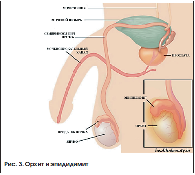 Воспаление почек у детей: симптомы и лечение, заболевания мочевыводящих путей