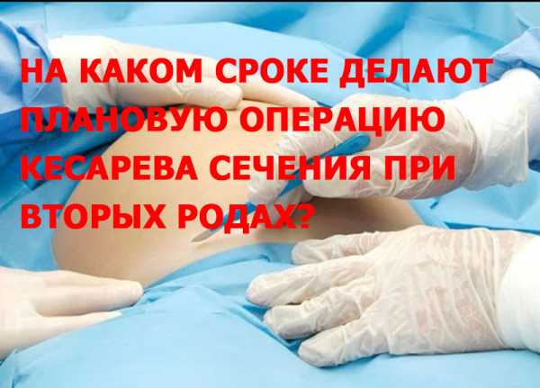 Второе кесарево сечение: на каком сроке делают и как проходит операция?