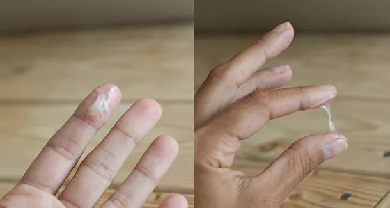 Выделения при овуляции: какие должны быть и что делать, если есть мазня?