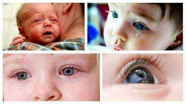 Зондирование слезного канала у новорожденных и детей до года: видео, последствия операции