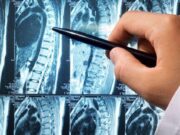 Как проходит диагностика МРТ грудного отдела