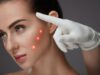 Особенности процедуры: лазерного омоложения лица