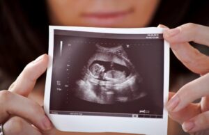 Что представляет собой скрининг 1 триместра беременности