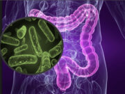 Что такое шигелез