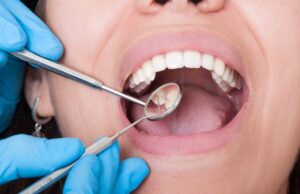 Удаление зуба мудрости: показания, противопоказания, этапы выполнения процедуры